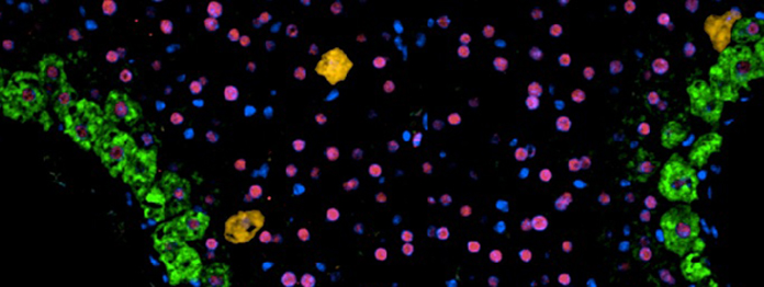 Hepatobiliary Cancer